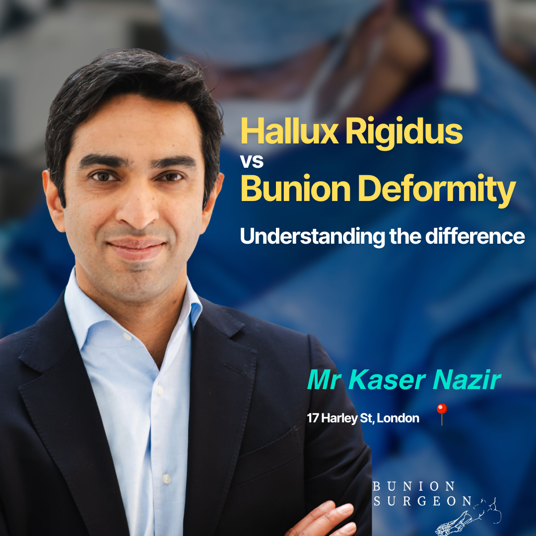 Kasear Nazir - Bunion Surgeon in Harley Street, London, Bunion Treatment Specialist