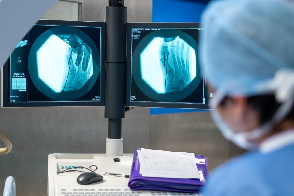 Bunion Recurrence After Surgery: Why It Happens and How to Prevent It